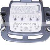Echo Color Doppler 3D Function Laptop/Notebook Ultrasound thumbnail-6