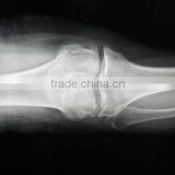CE KND-A/F Medical Thermal x Ray Film China thumbnail-6