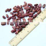 Red Speckled Kidney Beans thumbnail-6