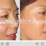 New Designed Bipolar RF Skin Tightening Face Lifting Beauty Equipment Price thumbnail-5