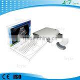 LTUB10 CE Medical Cheap Portable Ultrasound Machine