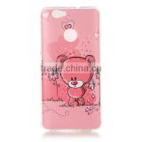OEM Cell Phone Multi Pattern IMD Craft Cases Ultra Thin TPU Phone Back Cover For Huawei NOVA thumbnail-3