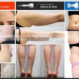 Focused Ultrasound Body Shaping Machine/Salushape Fat Shaping Machine/HIFU Fat Shaping Machine thumbnail-2