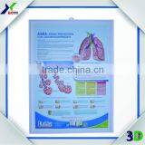 Custom Medical PVC 3D Poster