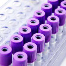 EDTA K2/K3 Blood Collection Tube thumbnail-4