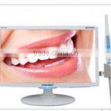 Portable Dental Unit Small Package Dental Spare Parts/Oral Camera/Dental Monitor Frame thumbnail-2