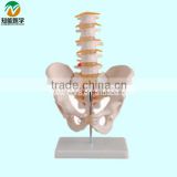 Life-size pelvis model with 5 lumber vertebra BIX-A1022