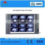 High Brigtness Medical X-ray Film Viewer thumbnail-1