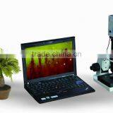 14 inch laptop Nail Microcirculation Microscope