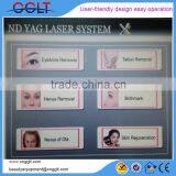 Laser Tattoo Removal Victory thumbnail-2