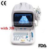 2015 New Full Digital Portable Ultrasound Scanner (PC) thumbnail-1