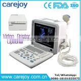 Carejoy Ultrasound Machine Portable Ultrasound Scanner With Multi Frequency Probe for Hospital Clinics Community With CE ISO thumbnail-1
