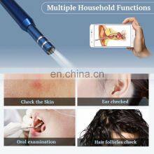 Ear Cleaning Endoscope Otoscope 720 HD Camera Cleansing Earwax Removal Tool thumbnail-2