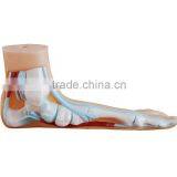 Flat Foot thumbnail-1
