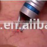 QTS 2016 Blood Vessels Spider Veins Removal ,with 980nm Wavelength Laser thumbnail-4