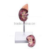 Life-size Organs Human Body Anatomy Kidney Model thumbnail-2