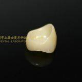 Dental Crown Zirconia PFZ, Dental Teeth, Dental Prosthesis, Laboratoire Dentaire, Dentallabor, Laboratorio Dental, Dental Laboratory, Shenzhen LJ Dental Lab China thumbnail-2