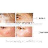 Radio Frequency RF Wrinkle Removal Machine Stretch Mark/best Skin Rejuvenation/ Skin Lifting Radio Frequency thumbnail-6