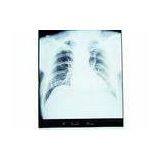 11in * 14in, Konida Medical Paper Laser Imaging Film For KND-DRYTEC-3000 thumbnail-1