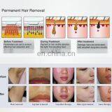 IPL Double Handle For Hair Removal / Skin Rejuvenation Portable Epilation Machine For Sale thumbnail-4