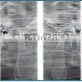 China Cheap Dental Panoramic and Cephalometric X-ray Machine thumbnail-4