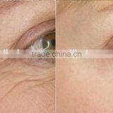 2016 Newest Portable Fractional RF Machine Radio Frequency/Best RF Skin Tightening Face Lifting Machine thumbnail-6