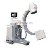 MY-D049V Hospital Device 500mA Digital Mobile Radiography System Medical x Ray Machine Price X-ray Scanner thumbnail-4