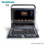 Trolley Mobile Color Doppler SonoScape S9 Ultrasound Machine for Sale
