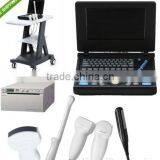 Full Digital Laptop Ultrasound Scanner(PC) thumbnail-1
