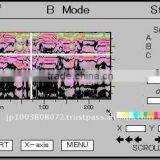 High Quality and Reliable Cavities Detection Radar Senci-on Beta With Multiple Functions Made in Japan thumbnail-6