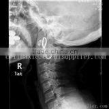 Konida Fuji Dry Film Medical X-ray Film for Sale thumbnail-1