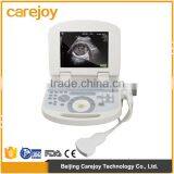 Hospital Used Medical Equipment Best Resolution Digital Portable Ultrasound Machine thumbnail-1