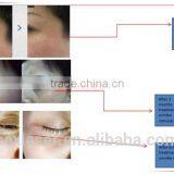 Portable Beauty Machine Eye Wrinkle Removal Machine thumbnail-6
