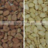 High Capacity Dal Optical Color Sorter in Agriculture thumbnail-2