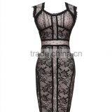 2015 New Elegant Fashion Black Lace Bandage Print Dress Bodycon Cute Girl Evening Party Dress thumbnail-1