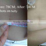 Professional High Frequency Machine 24*24=576 Spots In One Shot High Power Ultrasonic High Frequency  HIFU Focused Ultrasound Body Fat Reduction Slimming Machine Nasolabial Folds Removal thumbnail-3