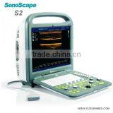 4D Portable Pregnancy Color Doppler Ultrasound Price thumbnail-3