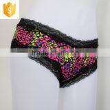 Professional OEM/ODM Factory Supply Sexy Women Underwear Sanitary Panties thumbnail-6
