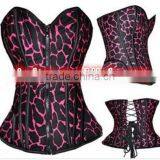 Women Sexy Yellow Goth Zipped Brocade Basque Spiral Steel Boned Corset Bustier thumbnail-1