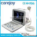 Full Digital LED Ultrasound Scanner B&W Ultrasound System thumbnail-1