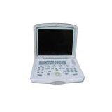 Portable Convex Ultrasound Scanner---CE Certified