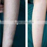 Ipl Laser Treatment for Hair Removal/mini Home Ipl Hair Removal Machine thumbnail-6