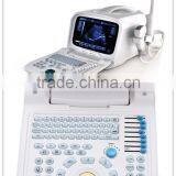 Professional Portable Ultrasound Scanner Ultrasonic Machine Multi-frequency Probe thumbnail-1