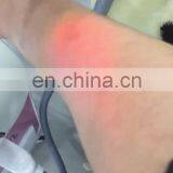 Hot Sale Ipl Permanent Painless Laser Hair Removal Machine Price