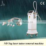 2016 New arrival Nd yag 1064nm 532nm laser tattoo removal machine price