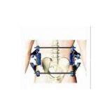 External Fixator:pelvic Fixator thumbnail-1