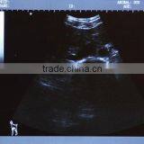 Laptop Veterinar Ultrasound Machine With Low Price thumbnail-5