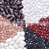 Small Round Shape Ight Speckled Kidney Bean Pinto Bean thumbnail-4