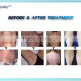 World Best Selling Products Beauty Machine Diode Laser for Hair Removal thumbnail-5