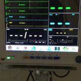 Medical Device Patient Monitor With 12.1 Inch TFT Color Screen thumbnail-4